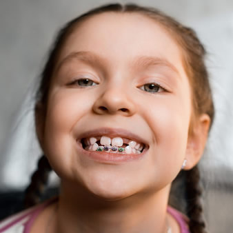 early orthodontic treatment