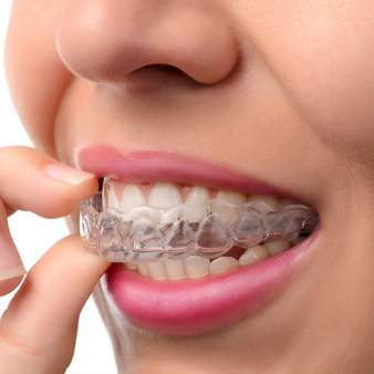orthodontic retention