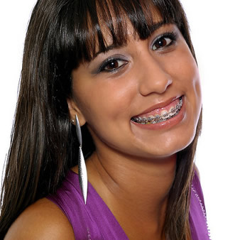 surgical orthodontics